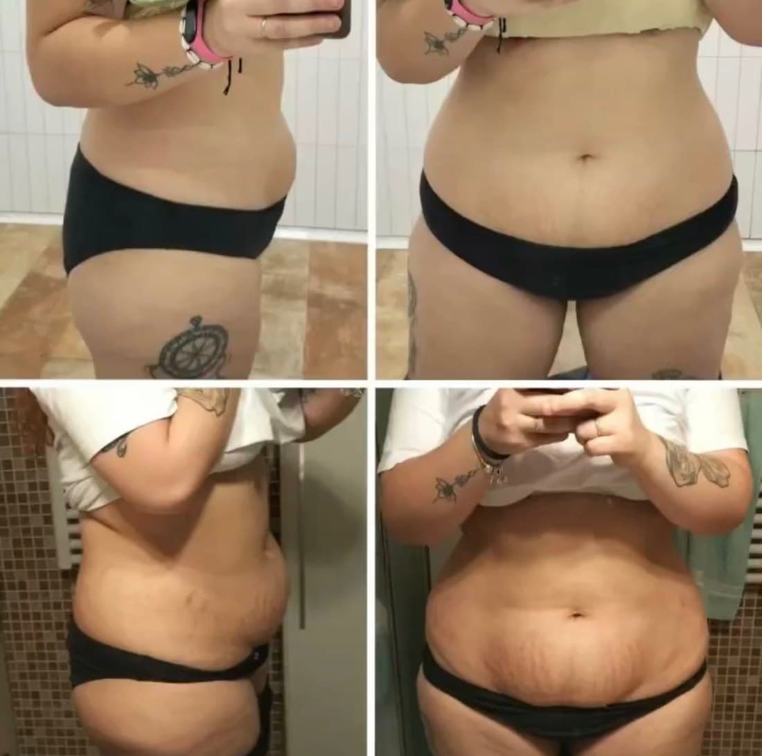 Antes y después de Nerea, cliente de Pata Negra Workout (3 meses)
